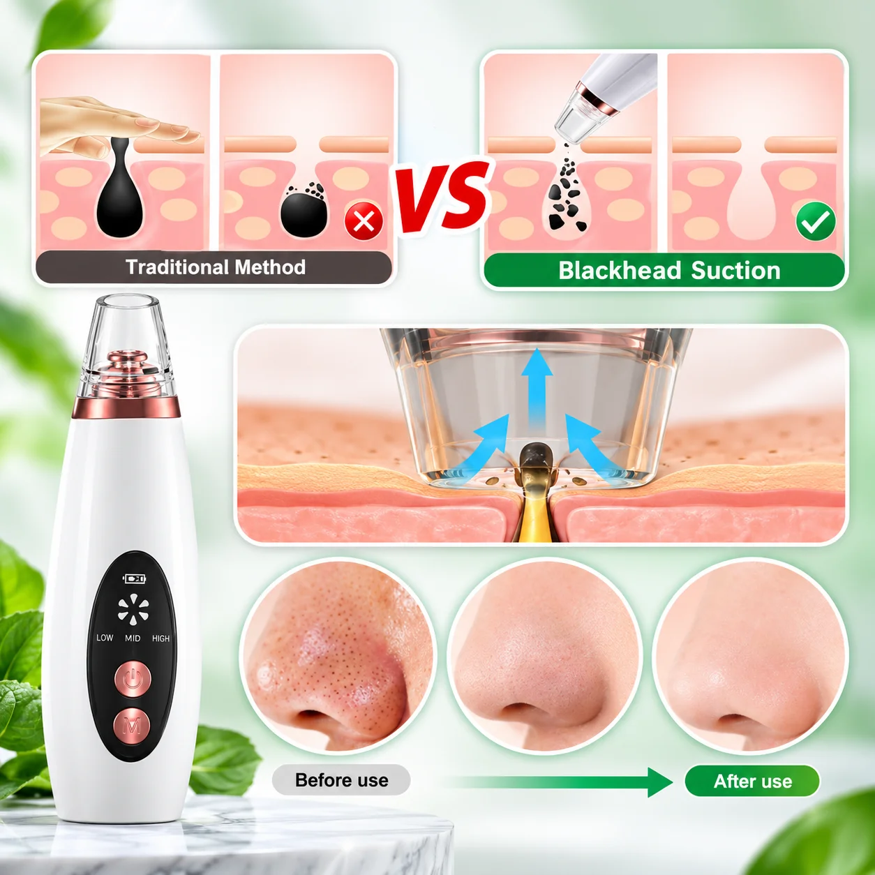 Multi-functional cleaning Blackhead Remover thumbnail 3