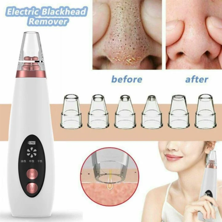 Multi-functional cleaning Blackhead Remover 5