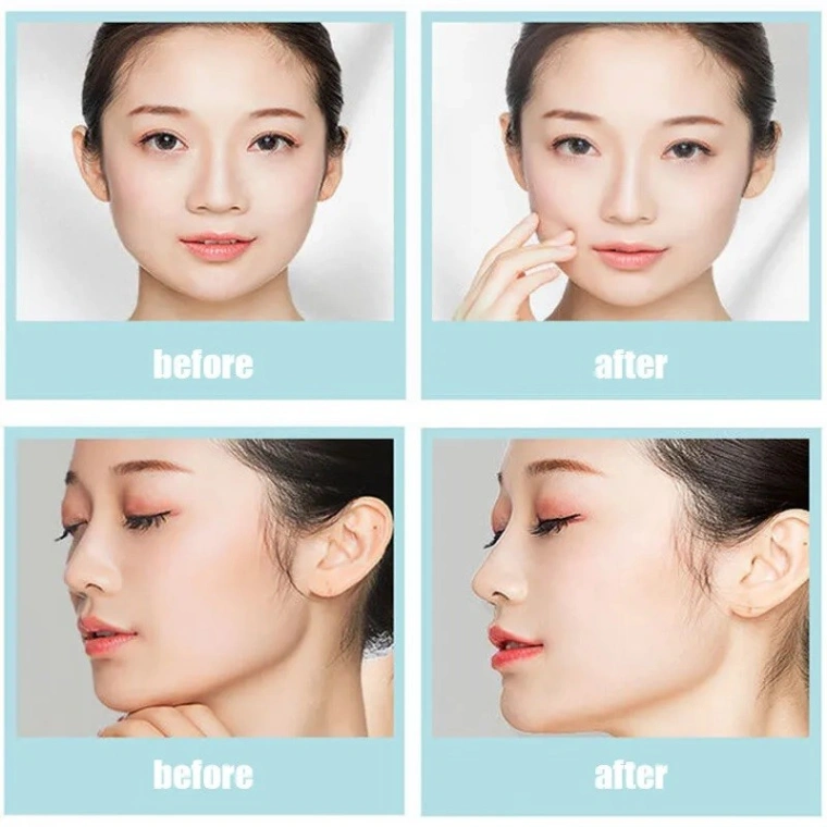 Nose Up Shaper Nose Slimmer Clip 3